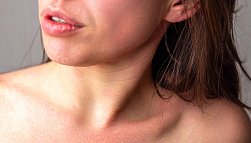 Аллергия на алкоголь