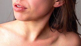 Аллергия на алкоголь