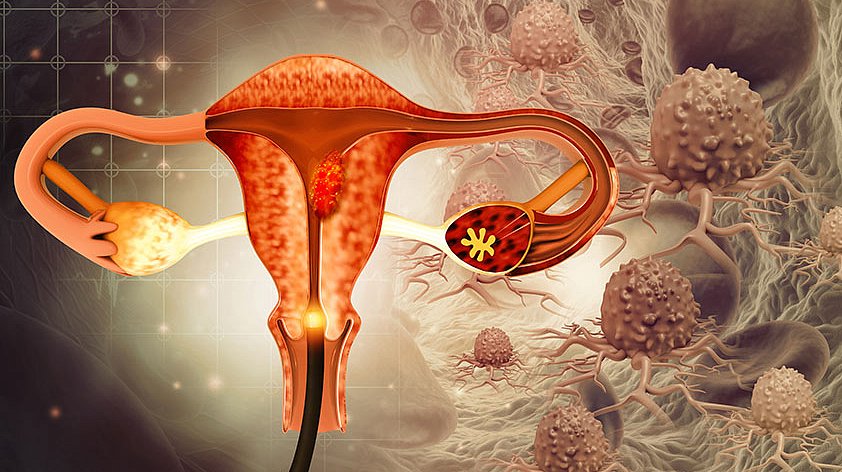 Комплексная диагностика патологических изменений тканей шейки матки и цервикального канала (жидкостная цитология, ПЦР-тест на ВПЧ)