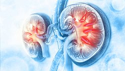 Гломерулонефрит