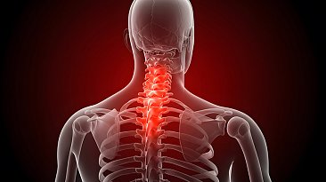 Гиперлордоз