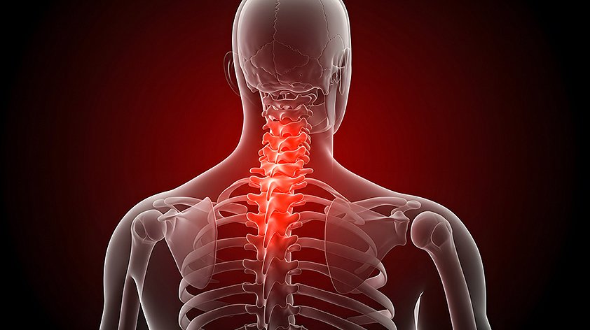 Гиперлордоз