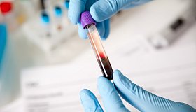 Загадка двойной группы крови