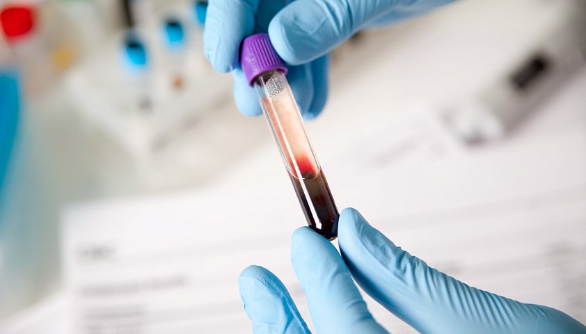 Загадка двойной группы крови