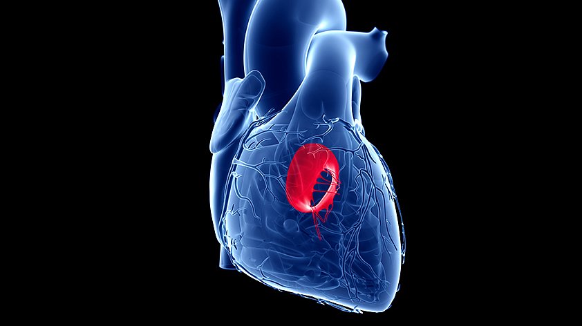 Патологии клапанов сердца: причины, симптомы, диагностика и лечение | Клиника «Наедине»