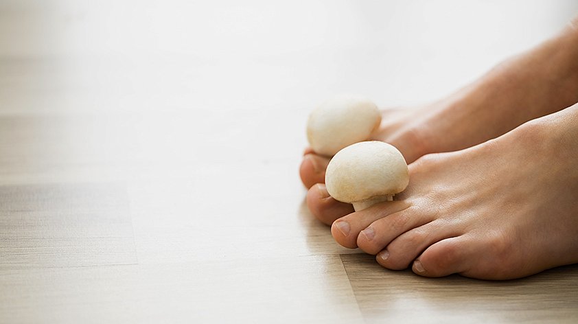 Как вылечить грибок на ногах: 11 народных рецептов, которые помогут