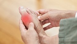 Лечение подагры