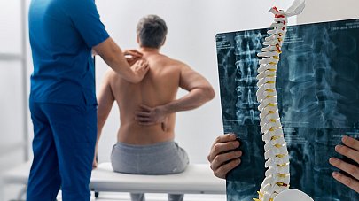 Спондилоартроз