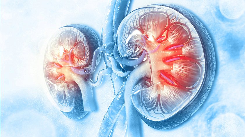 Гломерулонефрит