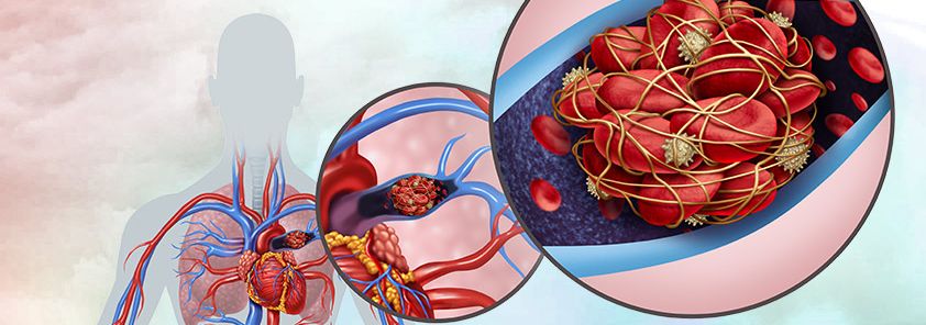 Почему некоторые люди внезапно умирают