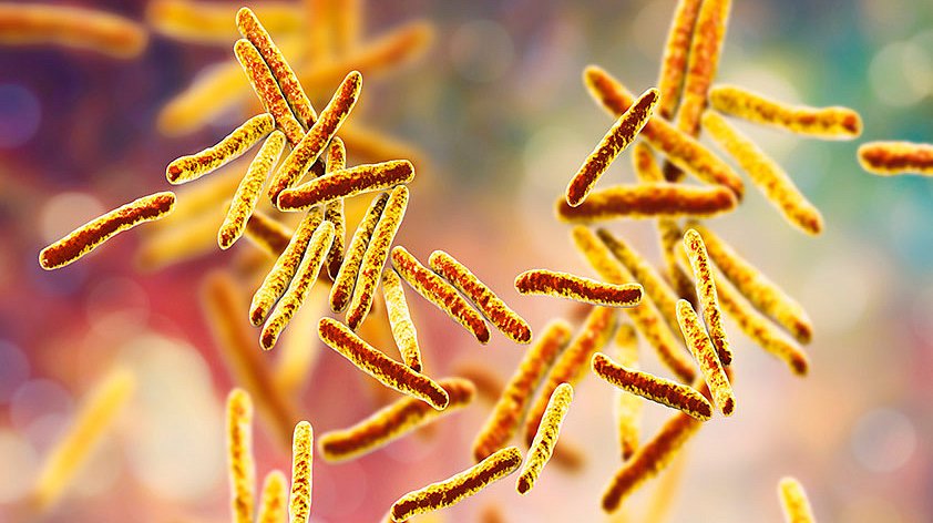 Можно ли по анализу крови определить туберкулёз