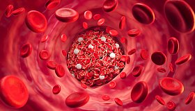 Тромбофлебит