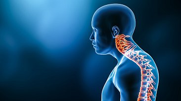 Патологический кифоз