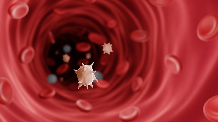 Тромбоцитопения