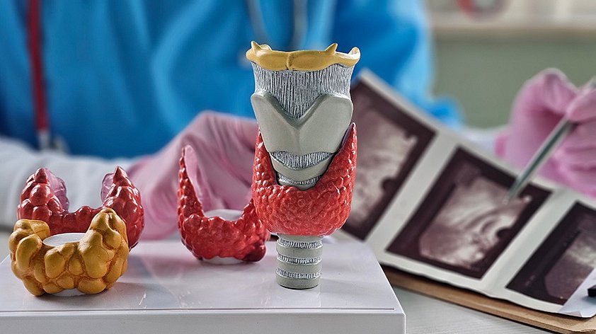 Тиреотоксикоз